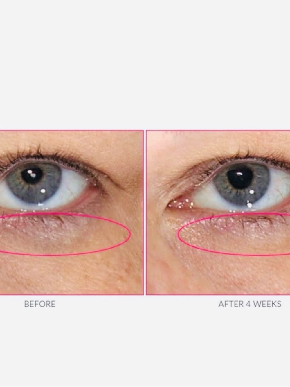 Kate Somerville Wrinkle Warrior Eye Gel - Hot Pink with Silver Cap - Picture 5 of 5